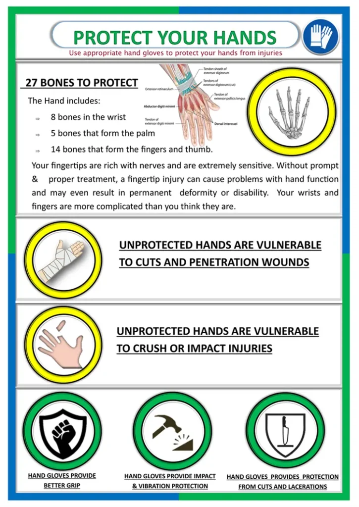 Safety poster hands and finger safety